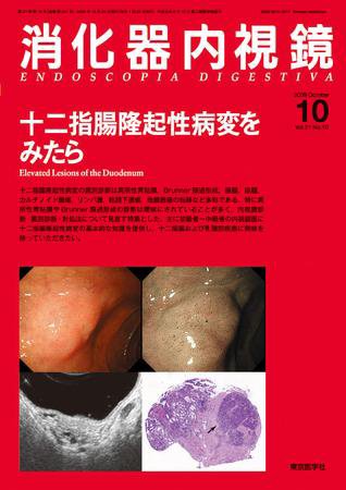 消化器内視鏡 09年10月号 (発売日2009年10月25日) | 雑誌/定期購読の