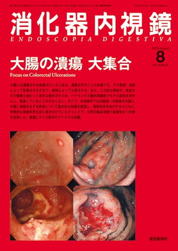 消化器内視鏡 10年8月号 (発売日2010年08月25日) 表紙