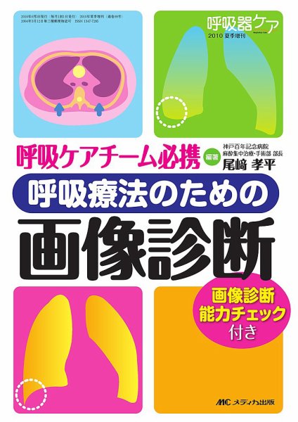 みんなの呼吸器 Respica（レスピカ）  夏季増刊 (発売日2010年05月31日) 表紙