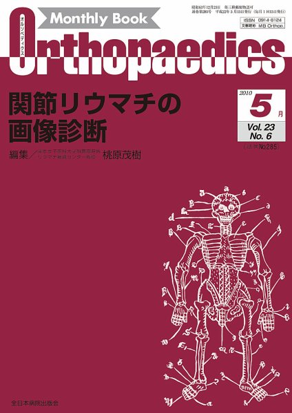 Orthopaedics（オルソペディクス） 23/6 (発売日2010年05月15日) 表紙