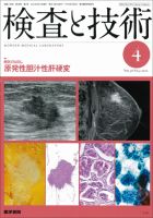 検査と技術 Vol.38 No.4 表紙