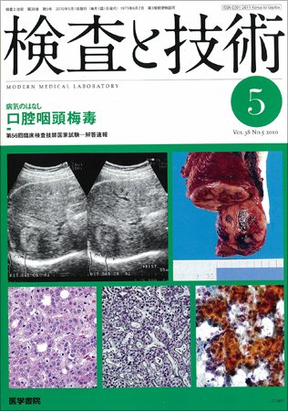 検査と技術 Vol.38 No.5 (発売日2010年05月01日) 表紙