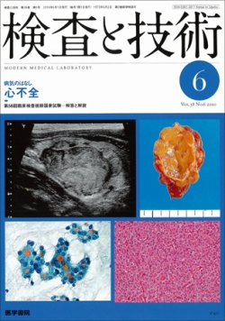 検査と技術 Vol.38 No.6 (発売日2010年06月01日) | 雑誌/定期購読の 