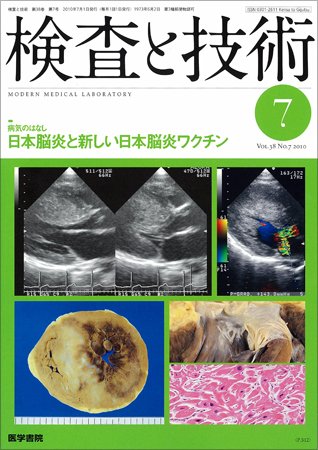 検査と技術 Vol.38 No.7 (発売日2010年07月01日) 表紙