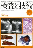 検査と技術 Vol.38 No.9 表紙