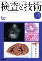 検査と技術 Vol.38 No.11 表紙