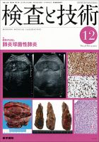 検査と技術 Vol.38 No.13 (発売日2010年12月01日) 表紙