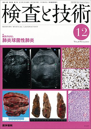 検査と技術 Vol.38 No.13 (発売日2010年12月01日) 表紙