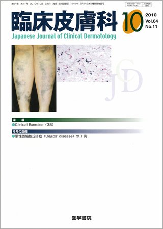 臨床皮膚科 64巻11号 (発売日2010年10月01日) 表紙