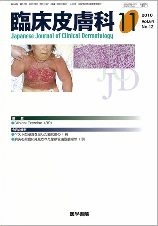 臨床皮膚科 64巻12号 (発売日2010年11月01日) 表紙