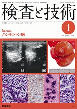 検査と技術 Vol.39 No.1 (発売日2011年01月01日) | 雑誌/定期