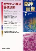 臨床画像のバックナンバー (4ページ目 45件表示) | 雑誌/定期購読の