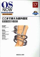 Amazon.co.jp: 装具療法: モデルと適応のすべて (新OS NOW新世代