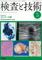 検査と技術 Vol.39 No.5 表紙