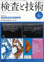 検査と技術 Vol.39 No.6 表紙