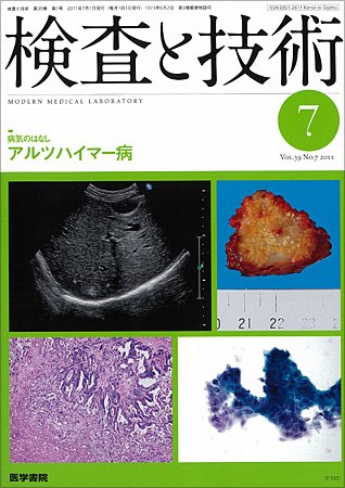 検査と技術 Vol.39 No.7 (発売日2011年07月01日) 表紙