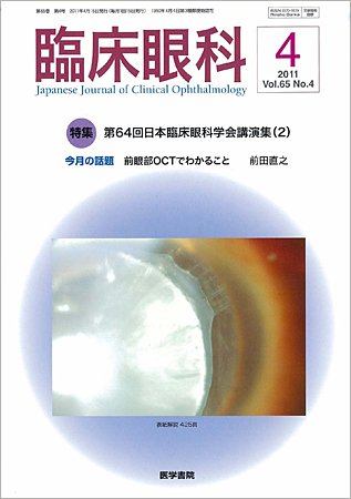 臨床眼科 Vol.65 No.4 (発売日2011年04月15日) 表紙