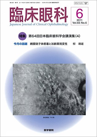 臨床眼科 Vol.65 No.6 (発売日2011年06月15日) 表紙