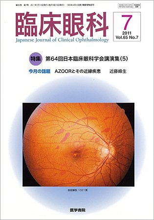 臨床眼科 Vol.65 No.7 (発売日2011年07月15日) 表紙