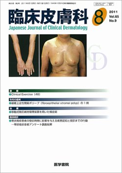 臨床皮膚科 65巻9号 (発売日2011年08月01日) | 雑誌/定期購読の
