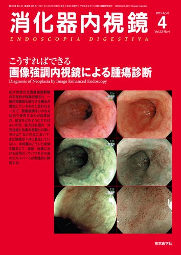 消化器内視鏡 11年4月増大号 (発売日2011年04月25日) 表紙
