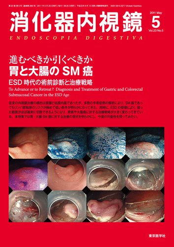 消化器内視鏡 11年5月号 (発売日2011年05月25日) 表紙