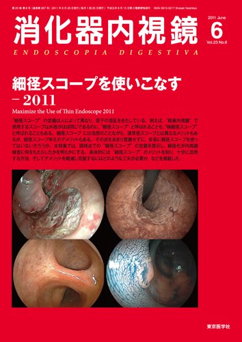 消化器内視鏡 11年6月号 (発売日2011年06月25日) 表紙