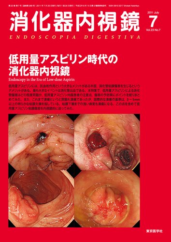消化器内視鏡 11年7月号 (発売日2011年07月25日) 表紙