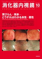 消化器内視鏡 11年10月号 表紙