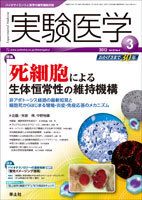 実験医学 Vol.30No.4 (発売日2012年02月20日) 表紙