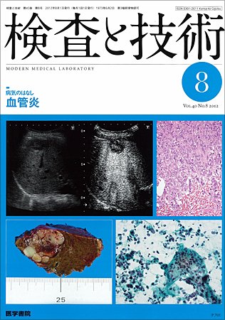 検査と技術 Vol.40 No.8 (発売日2012年08月01日) 表紙
