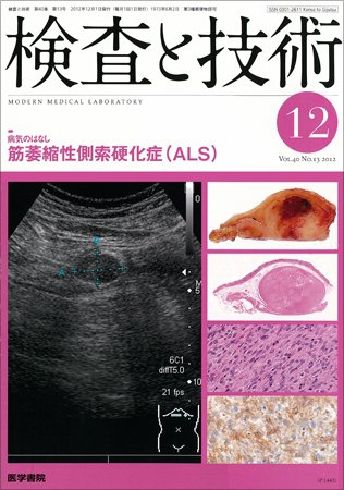 検査と技術 Vol.40 No.13 (発売日2012年12月01日) 表紙