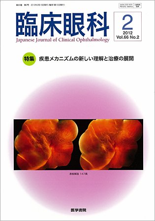 臨床眼科 Vol.66 No.2 (発売日2012年02月15日) 表紙
