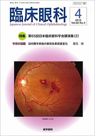 臨床眼科 Vol.66 No.4 (発売日2012年04月15日) 表紙