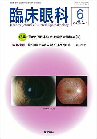 臨床眼科 Vol.66 No.6 (発売日2012年06月15日) 表紙