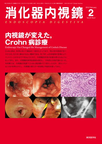 消化器内視鏡 12年2月号 (発売日2012年02月25日) 表紙