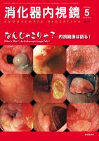消化器内視鏡 12年5月増大号 表紙