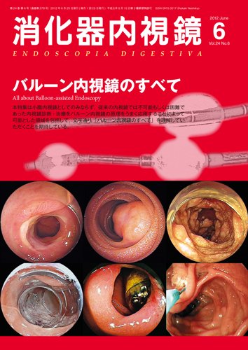 消化器内視鏡 12年6月号 (発売日2012年06月25日) 表紙