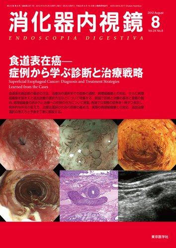 消化器内視鏡 12年8月号 (発売日2012年08月25日) 表紙