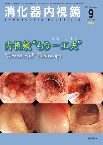 消化器内視鏡 12年9月増大号 (発売日2012年09月25日) 表紙