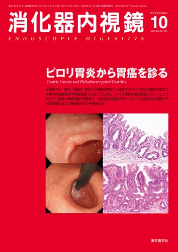消化器内視鏡 12年10月号 (発売日2012年10月25日) 表紙