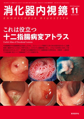 消化器内視鏡 12年11月号 (発売日2012年11月25日) | 雑誌/定期購読の