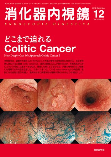 消化器内視鏡 12年12月号 (発売日2012年12月25日) 表紙