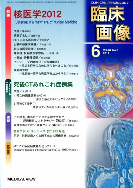 臨床画像 2012年6月号 (発売日2012年05月28日) 表紙
