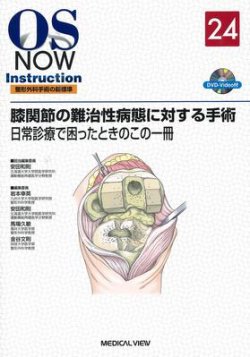 OS NOW 「人工膝関節置換術 適切なアライメントとバランスの獲得をめざして」 - 健康/医学