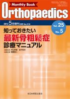 オルソペディクス2023年1-5月号 Monthly Book Orthopaedics（オルソペディクス） 38/5|全日本病院出版会