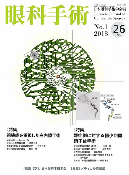 眼科手術 Vol.26 No.1 (発売日2013年01月30日) 表紙