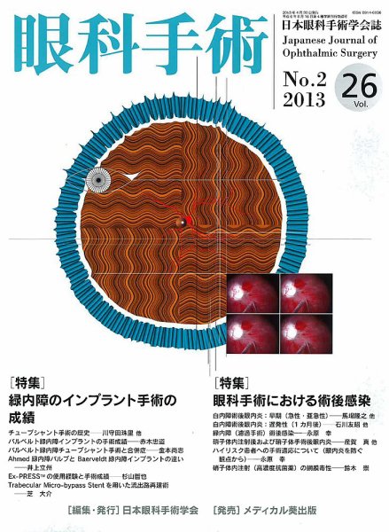 眼科手術 Vol.26 No.2 (発売日2013年04月30日) 表紙