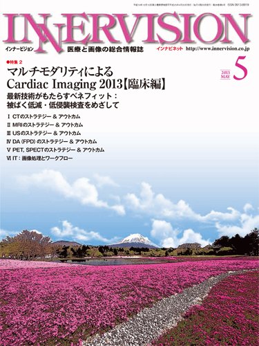 INNERVISION（インナービジョン） 2013年5月号 (発売日2013年05月01日) 表紙