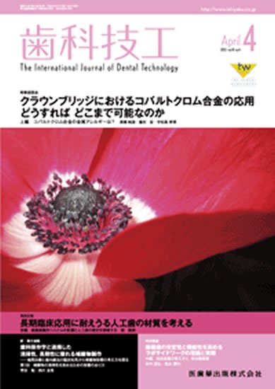 歯科技工 41巻4号 (発売日2013年03月25日) 表紙